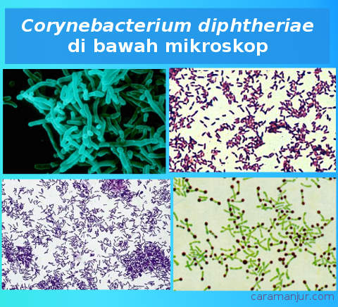 gambar bakteri difteri di bawah mikroskop