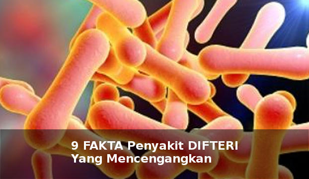 9 Fakta Penyakit Difteri Yang Wajib Anda Tahu